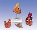 Classic Heart Anatomy with Thymus, 3 part model